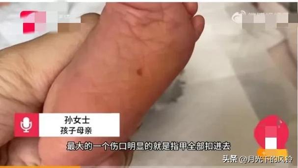 刚当宝妈应该知道什么「女婴被月嫂挠伤脚底视频」 玻璃资讯